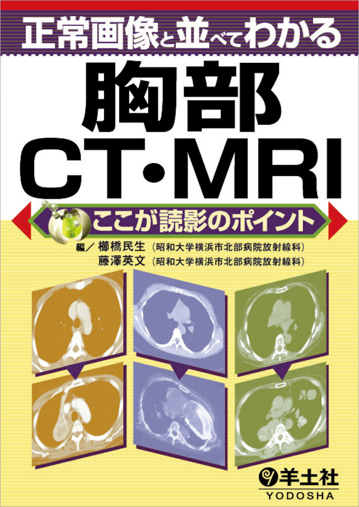 正常画像と並べてわかる胸部CT・MRI