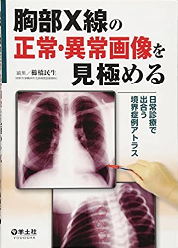 胸部X線の正常・異常画像を見極める