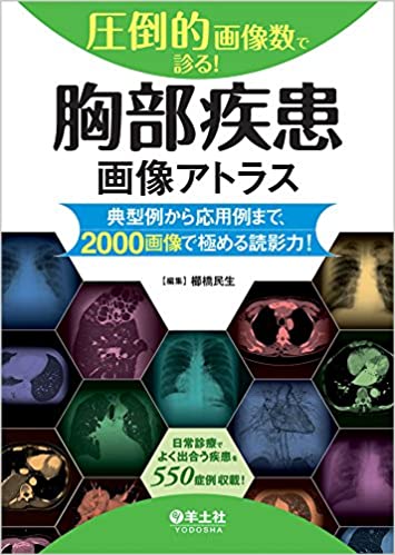 圧倒的画像数で診る! 胸部疾患画像アトラス